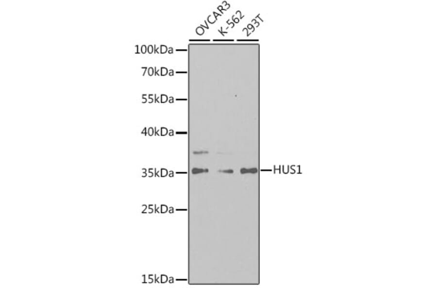 Western Blot - Anti-HUS1 Antibody (A14741) - Antibodies.com