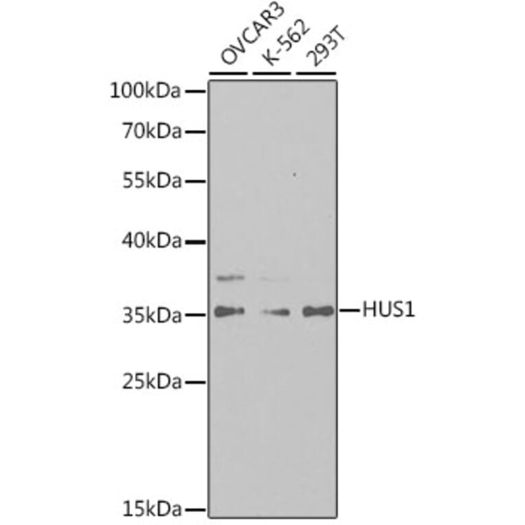 Western Blot - Anti-HUS1 Antibody (A14741) - Antibodies.com