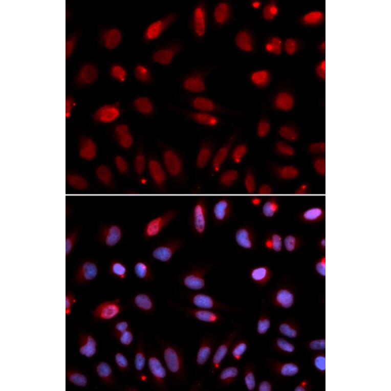 Immunofluorescence - Anti-HUS1 Antibody (A14741) - Antibodies.com