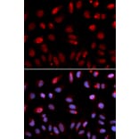 Immunofluorescence - Anti-HUS1 Antibody (A14741) - Antibodies.com