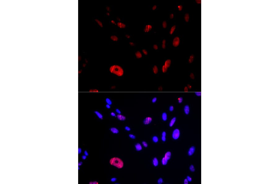 Immunofluorescence - Anti-HUS1 Antibody (A14741) - Antibodies.com