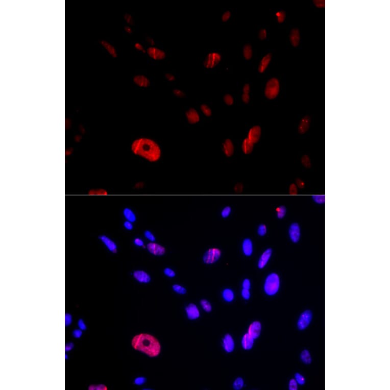 Immunofluorescence - Anti-HUS1 Antibody (A14741) - Antibodies.com