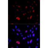 Immunofluorescence - Anti-HUS1 Antibody (A14741) - Antibodies.com