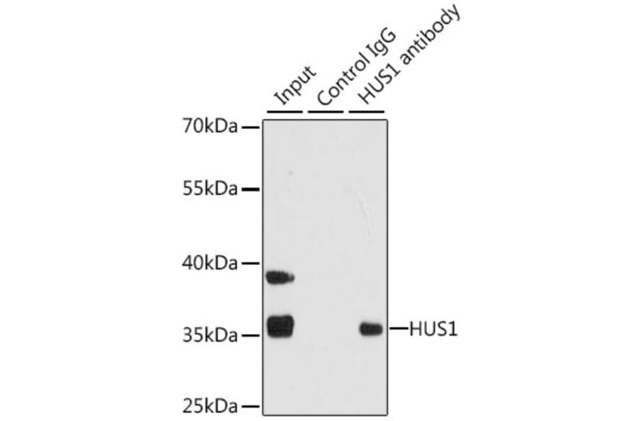 Western Blot - Anti-HUS1 Antibody (A14741) - Antibodies.com