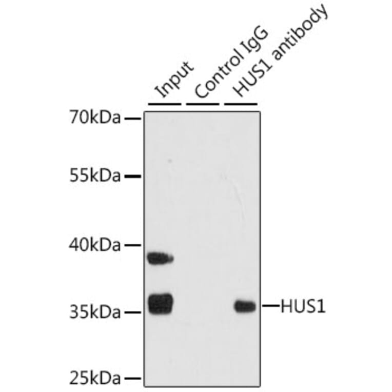 Western Blot - Anti-HUS1 Antibody (A14741) - Antibodies.com