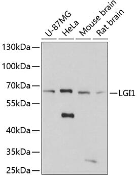 Western blot analysis of extracts of various cell lines, using Anti-LGI1 Antibody (A5408) at 1:3000 dilution.
Secondary antibody: Goat Anti-Rabbit IgG (H+L) (HRP) (AS014) at 1:10,000 dilution.
Lysates / proteins: 25µg per lane.
Blocking buffer: 3% non-fat dry milk in TBST.
Detection: ECL Basic Kit (RM00020).
Exposure time: 90s.