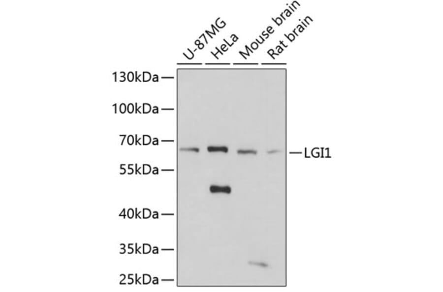 Western Blot - Anti-Lgi1/EPT Antibody (A14742) - Antibodies.com