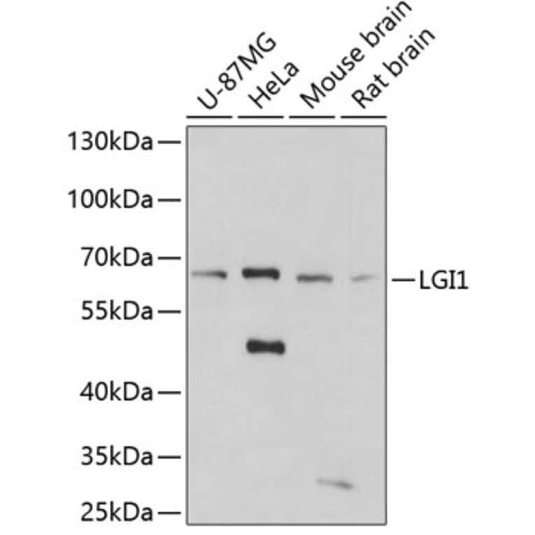 Western Blot - Anti-Lgi1/EPT Antibody (A14742) - Antibodies.com