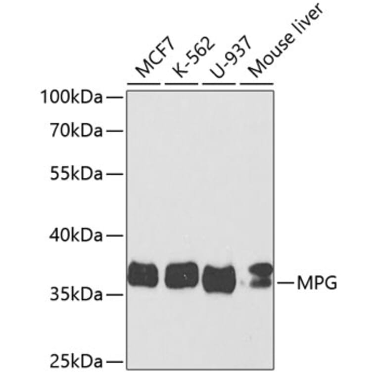 Western Blot - Anti-MPG / AAG Antibody (A14743) - Antibodies.com
