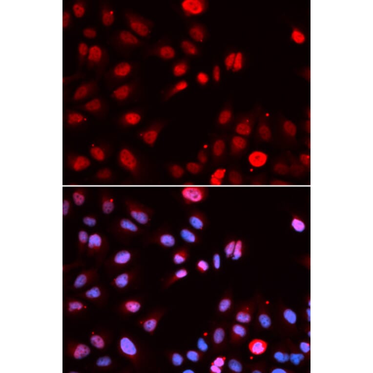 Immunofluorescence - Anti-MPG / AAG Antibody (A14743) - Antibodies.com