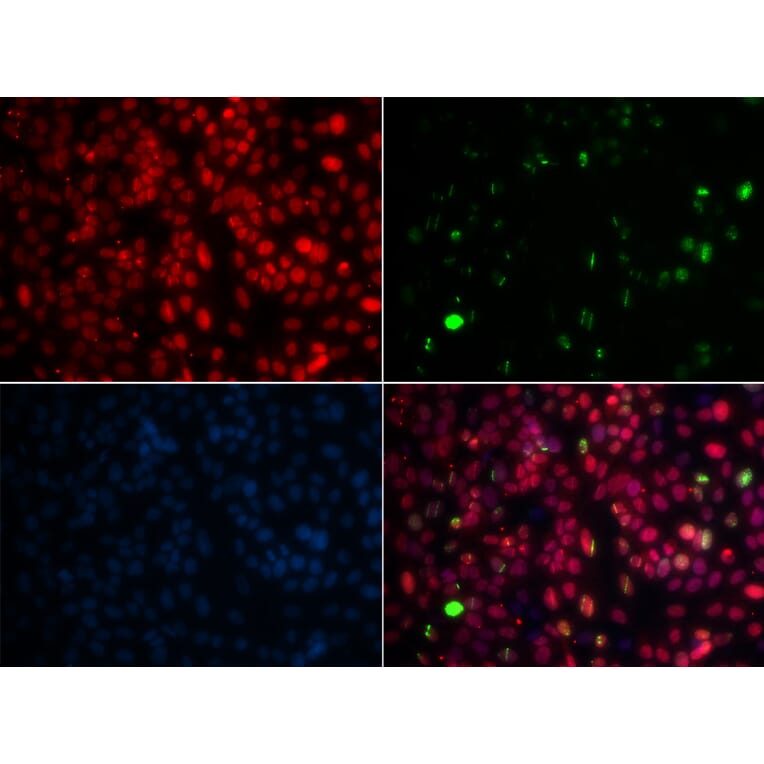 Immunofluorescence - Anti-MPG / AAG Antibody (A14743) - Antibodies.com