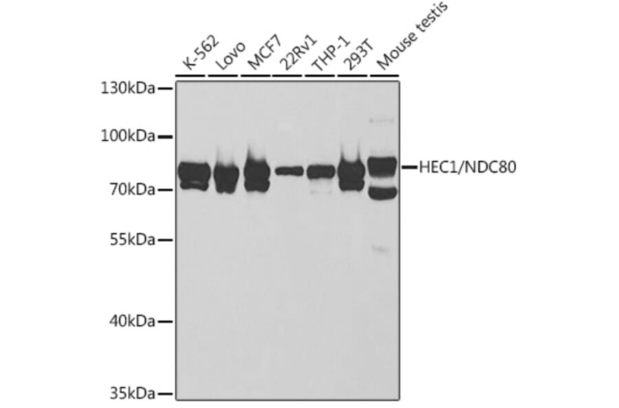 Western Blot - Anti-HEC1/HEC Antibody (A14744) - Antibodies.com