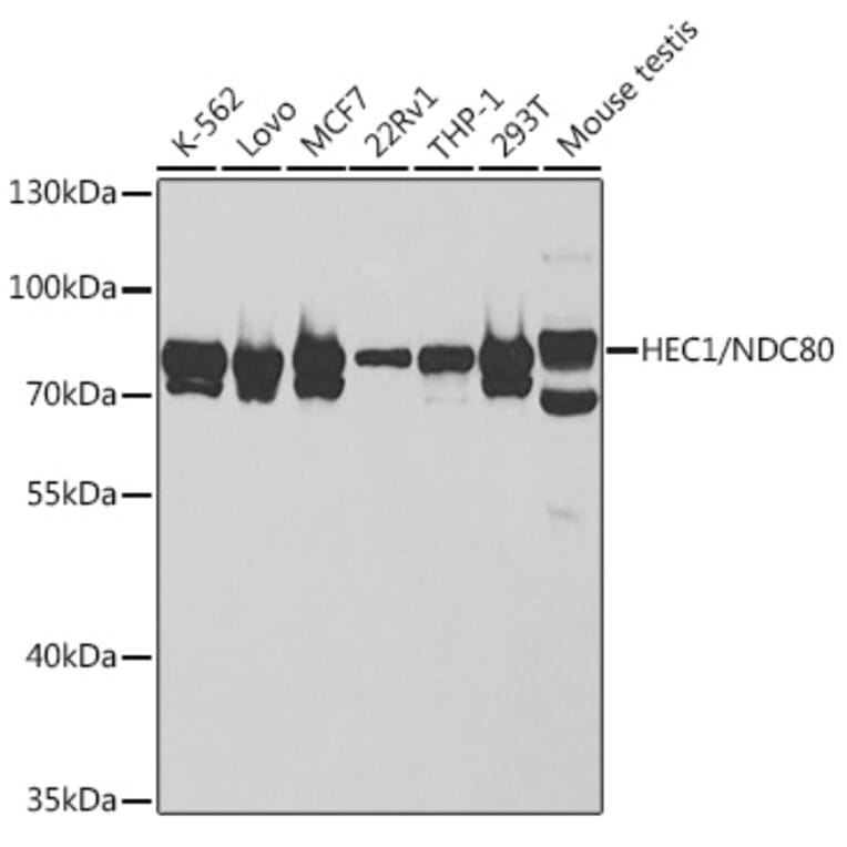 Western Blot - Anti-HEC1/HEC Antibody (A14744) - Antibodies.com