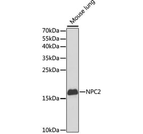 Western Blot - Anti-Niemann Pick C2 Antibody (A14746) - Antibodies.com