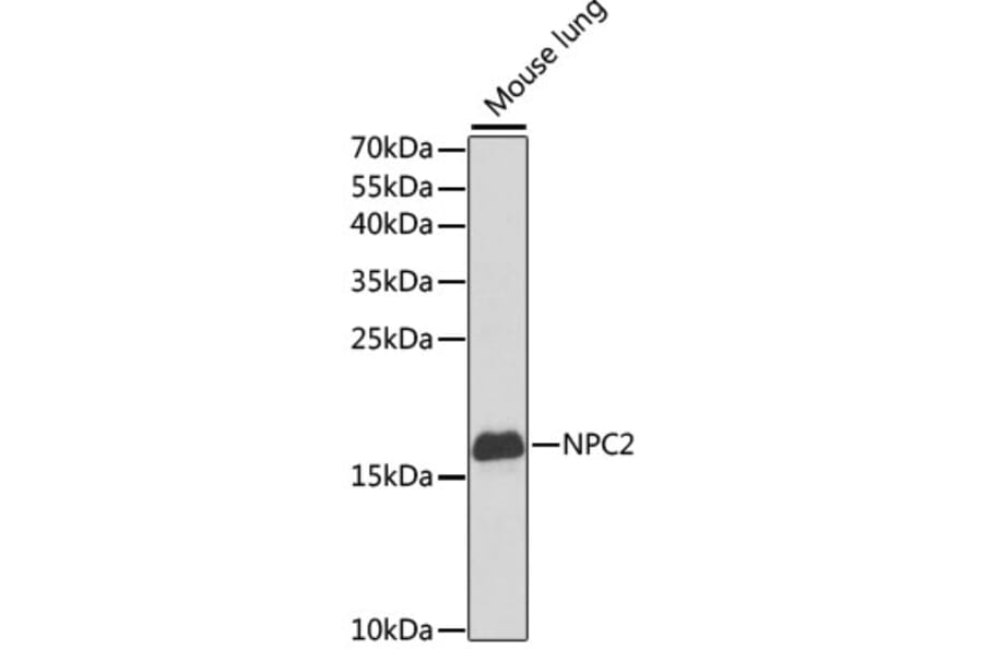 Western Blot - Anti-Niemann Pick C2 Antibody (A14746) - Antibodies.com