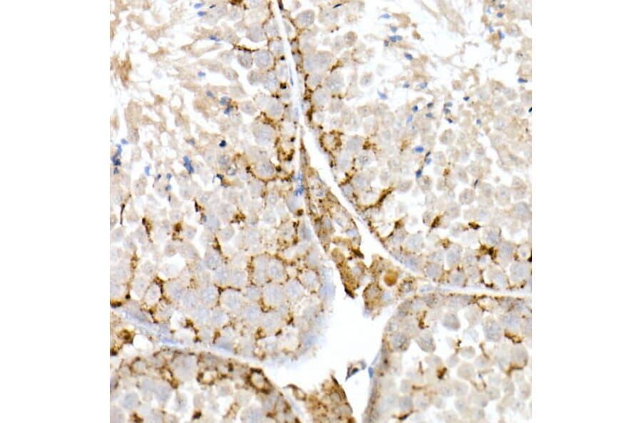 Immunohistochemistry - Anti-Niemann Pick C2 Antibody (A14746) - Antibodies.com
