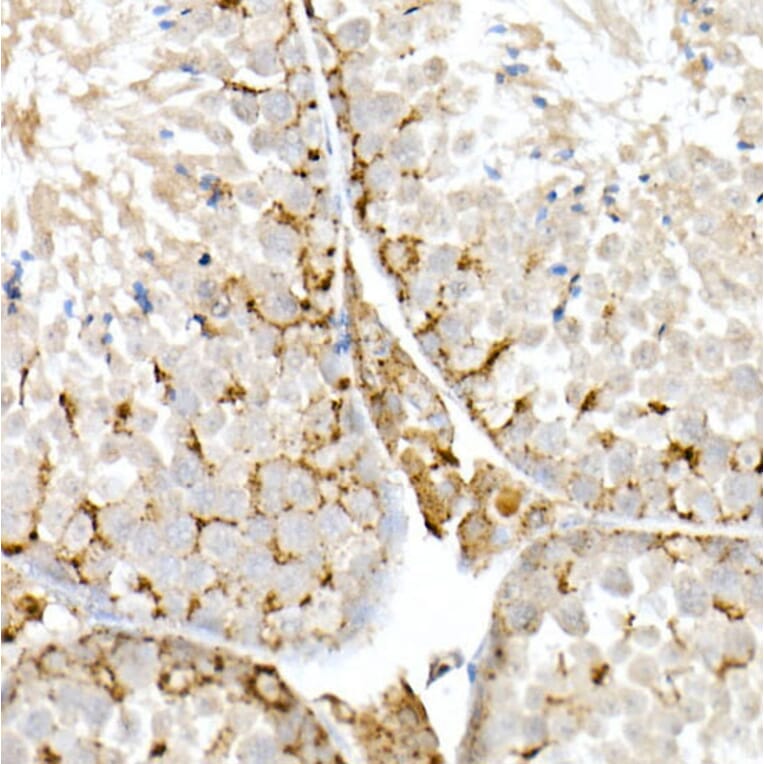 Immunohistochemistry - Anti-Niemann Pick C2 Antibody (A14746) - Antibodies.com
