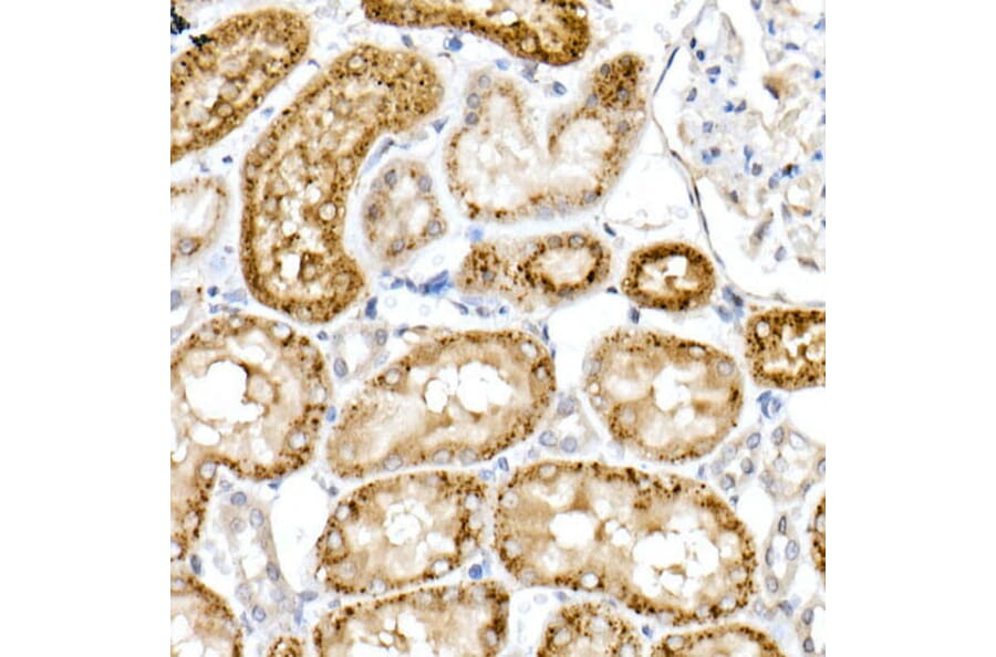 Immunohistochemistry - Anti-Niemann Pick C2 Antibody (A14746) - Antibodies.com