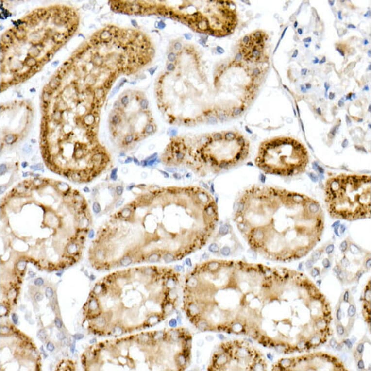 Immunohistochemistry - Anti-Niemann Pick C2 Antibody (A14746) - Antibodies.com