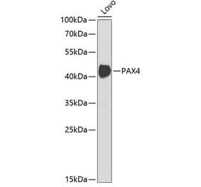 Western Blot - Anti-PAX4 Antibody (A14747) - Antibodies.com