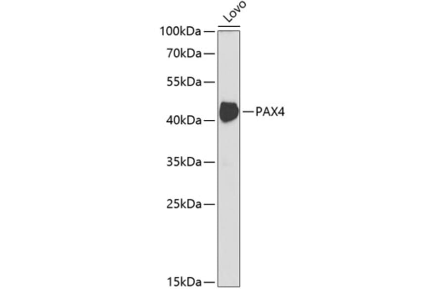 Western Blot - Anti-PAX4 Antibody (A14747) - Antibodies.com
