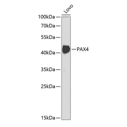 Western Blot - Anti-PAX4 Antibody (A14747) - Antibodies.com