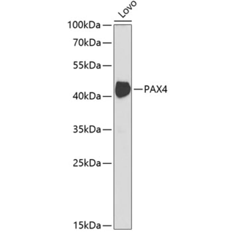 Western Blot - Anti-PAX4 Antibody (A14747) - Antibodies.com