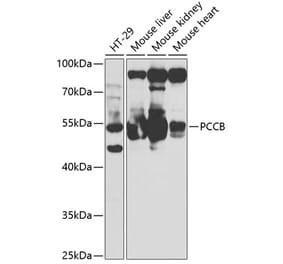 Western Blot - Anti-PCCB Antibody (A14748) - Antibodies.com