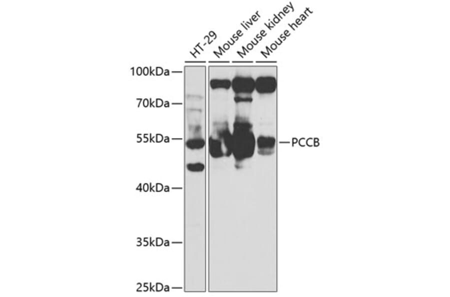 Western Blot - Anti-PCCB Antibody (A14748) - Antibodies.com