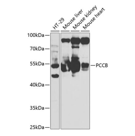 Western Blot - Anti-PCCB Antibody (A14748) - Antibodies.com