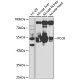 Western Blot - Anti-PCCB Antibody (A14748) - Antibodies.com