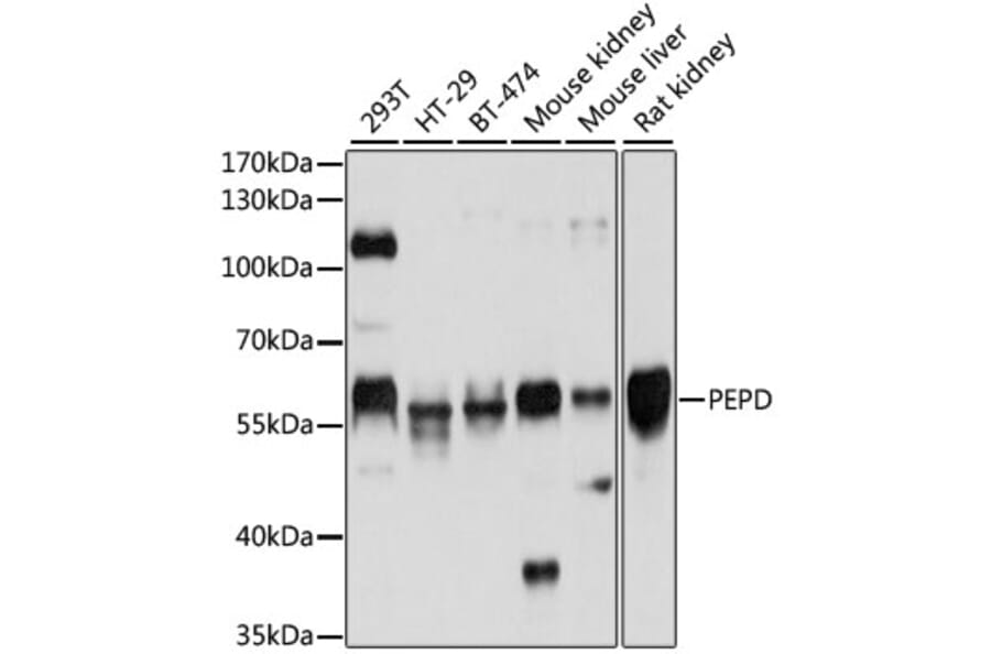Western Blot - Anti-PRD Antibody (A14749) - Antibodies.com