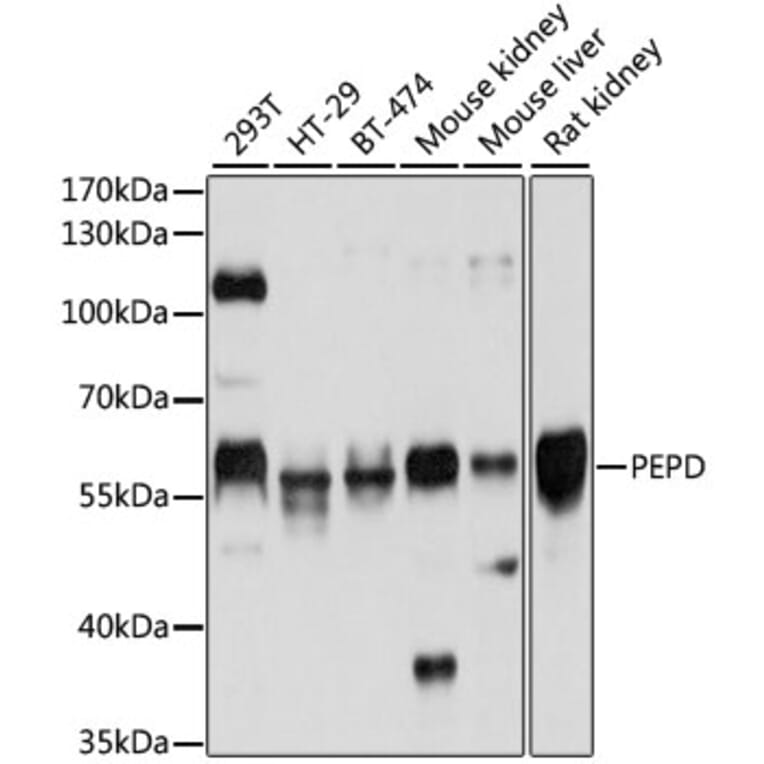 Western Blot - Anti-PRD Antibody (A14749) - Antibodies.com