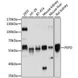 Western Blot - Anti-PRD Antibody (A14749) - Antibodies.com