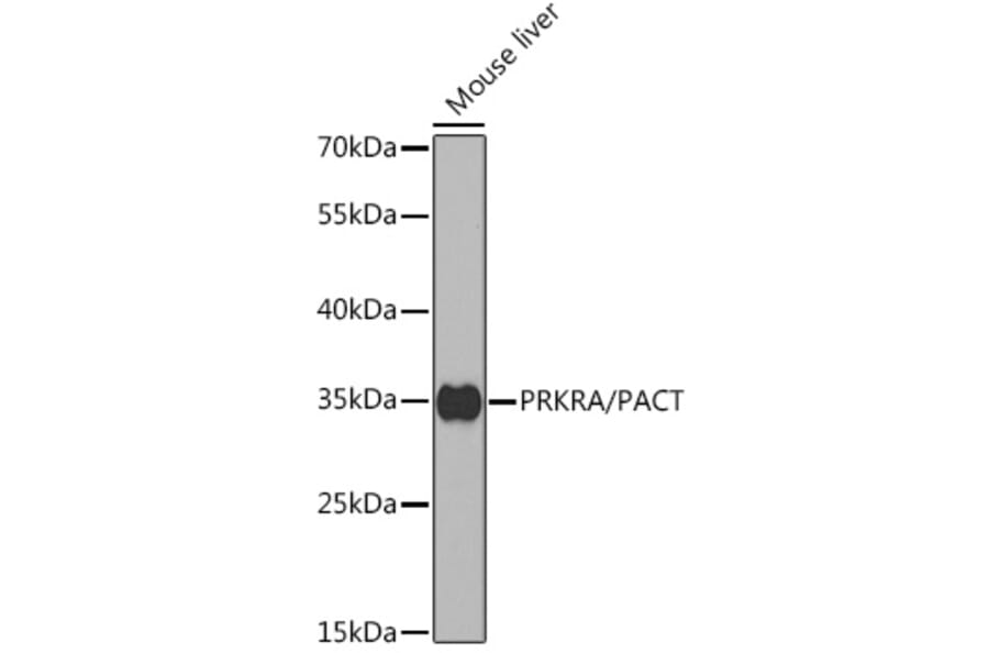 Western Blot - Anti-PACT (phospho KR activating protein)/PRKRA Antibody (A14750) - Antibodies.com