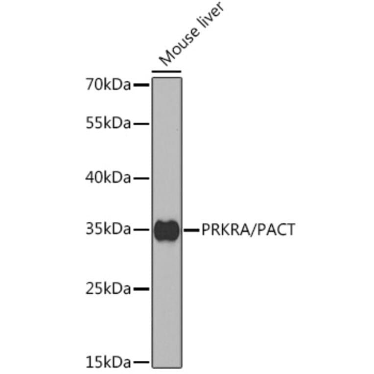 Western Blot - Anti-PACT (phospho KR activating protein)/PRKRA Antibody (A14750) - Antibodies.com
