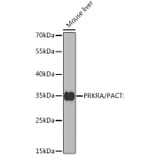 Western Blot - Anti-PACT (phospho KR activating protein)/PRKRA Antibody (A14750) - Antibodies.com