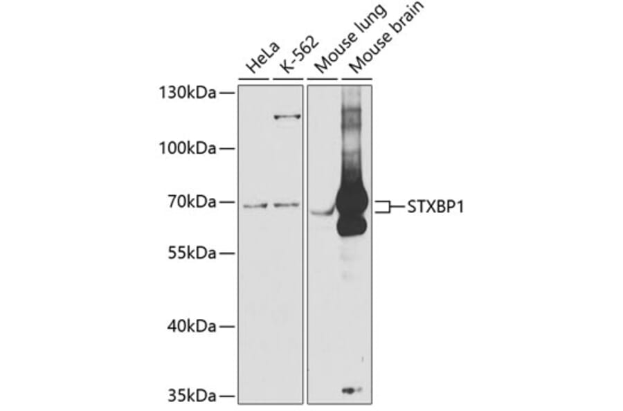 Western Blot - Anti-Munc18-1 Antibody (A14751) - Antibodies.com