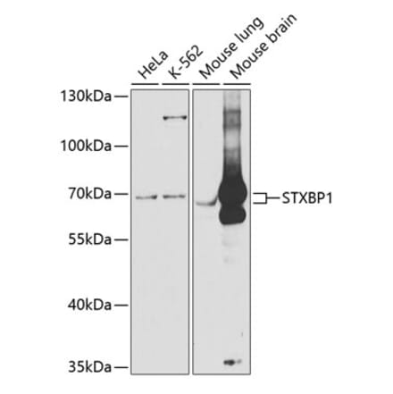 Western Blot - Anti-Munc18-1 Antibody (A14751) - Antibodies.com