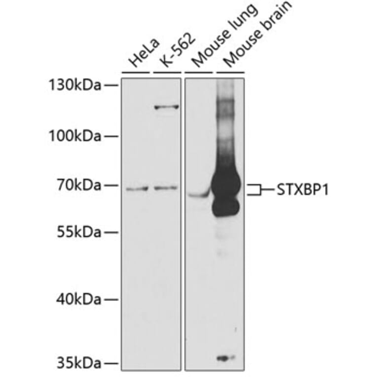 Western Blot - Anti-Munc18-1 Antibody (A14751) - Antibodies.com