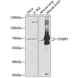 Western Blot - Anti-Munc18-1 Antibody (A14751) - Antibodies.com