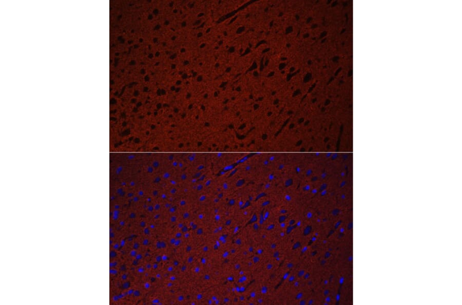 Immunofluorescence - Anti-Munc18-1 Antibody (A14751) - Antibodies.com
