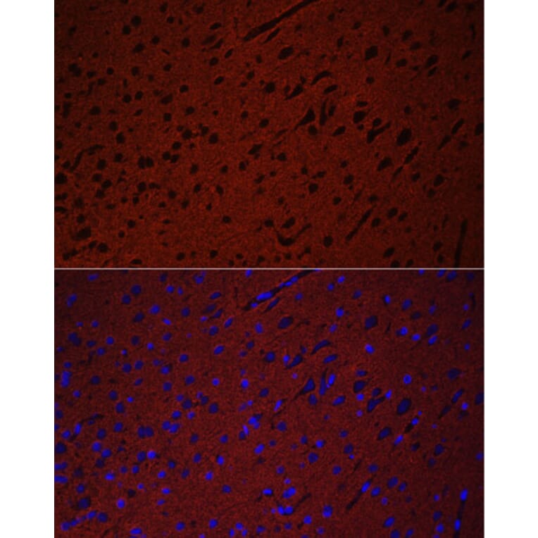 Immunofluorescence - Anti-Munc18-1 Antibody (A14751) - Antibodies.com