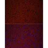 Immunofluorescence - Anti-Munc18-1 Antibody (A14751) - Antibodies.com