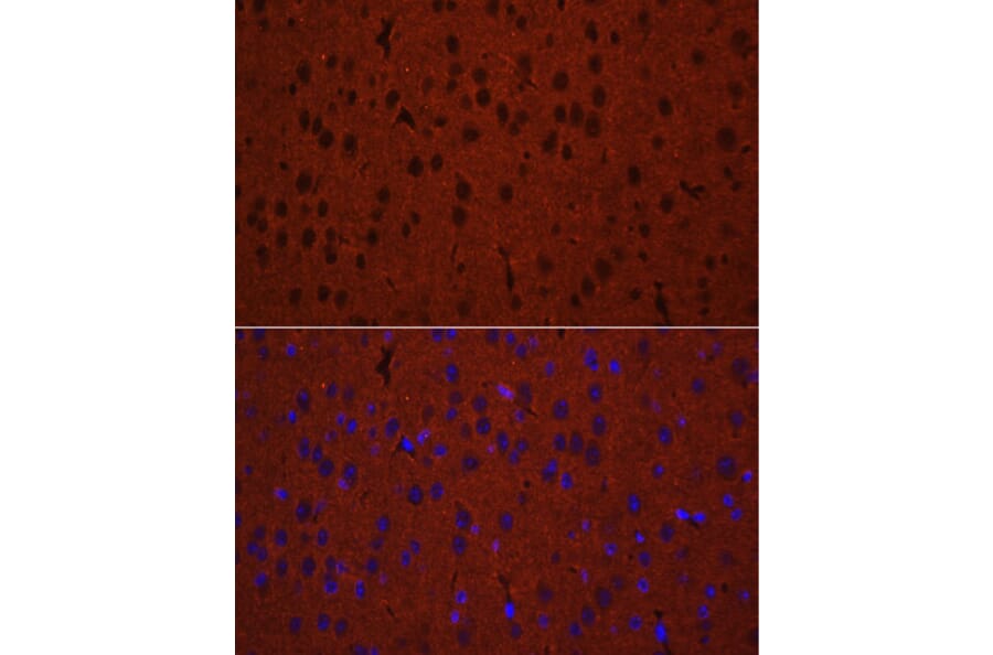 Immunofluorescence - Anti-Munc18-1 Antibody (A14751) - Antibodies.com