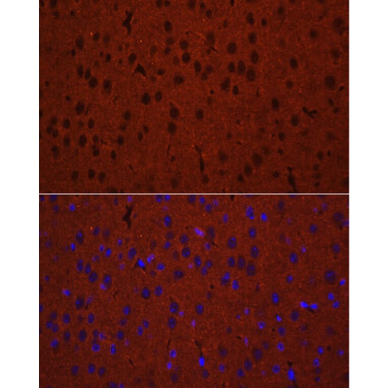 Immunofluorescence - Anti-Munc18-1 Antibody (A14751) - Antibodies.com