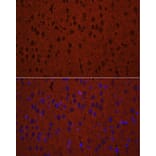 Immunofluorescence - Anti-Munc18-1 Antibody (A14751) - Antibodies.com