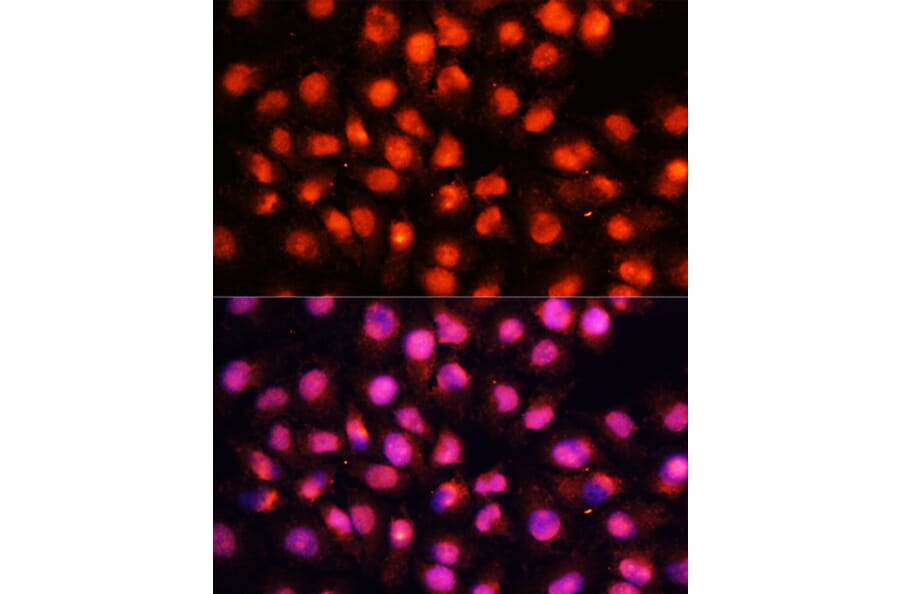Immunofluorescence - Anti-Munc18-1 Antibody (A14751) - Antibodies.com
