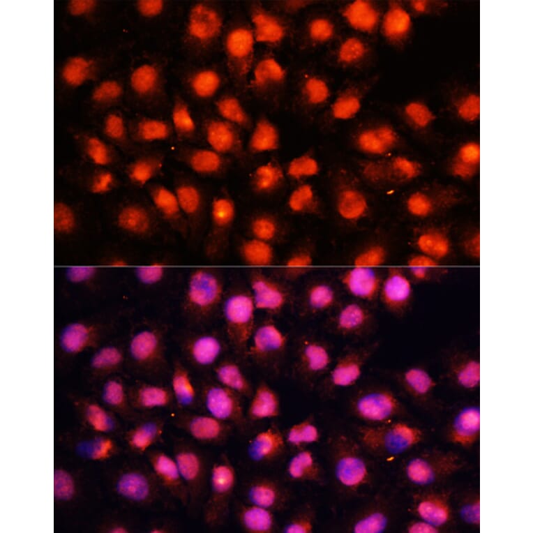 Immunofluorescence - Anti-Munc18-1 Antibody (A14751) - Antibodies.com