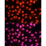 Immunofluorescence - Anti-Munc18-1 Antibody (A14751) - Antibodies.com